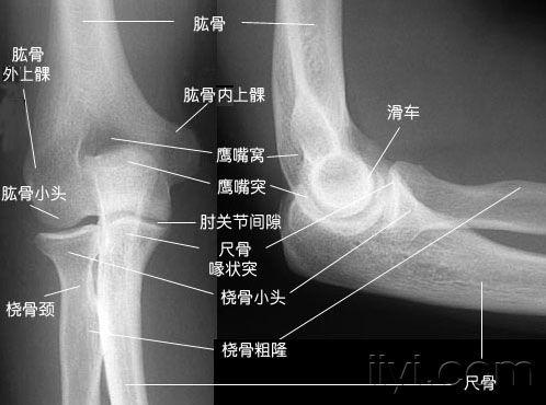 简易x线解剖图片