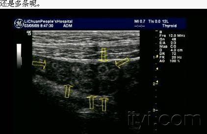 经典图片共享之十六 - 超声医学资源版 - 爱爱医医学