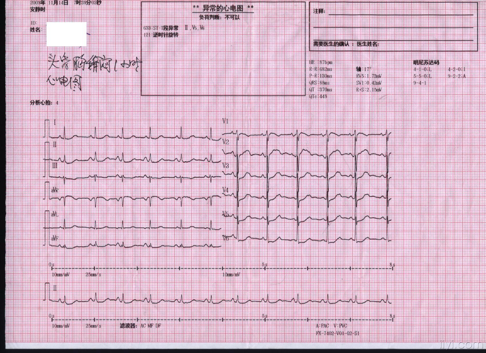 091114---七点三十分首次心电图.jpg
