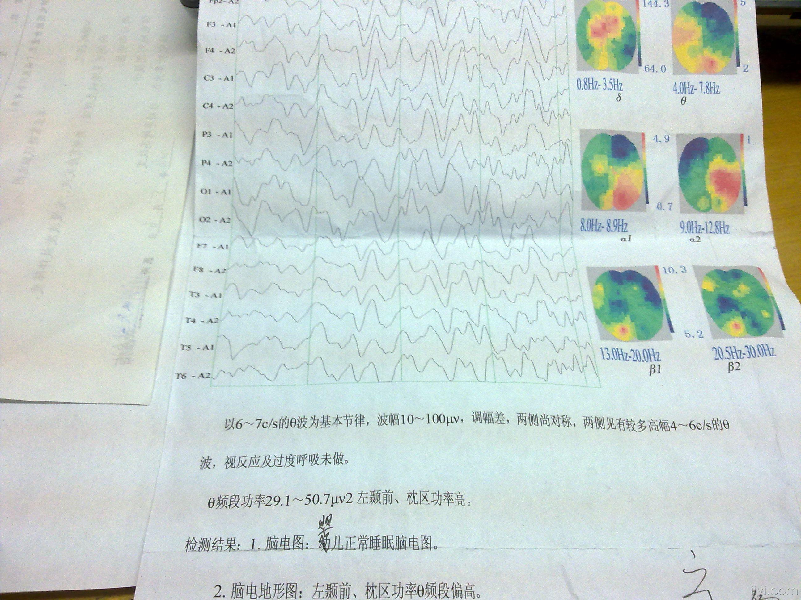 到底什么病【重新完善资料(婴儿抽搐?