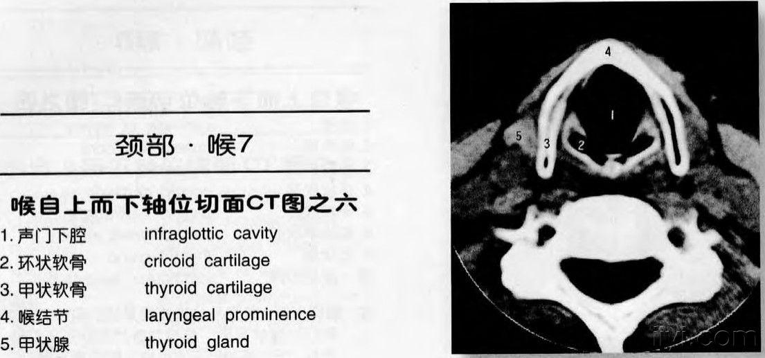 颈部ct解剖图谱jpg格式(申请加精)