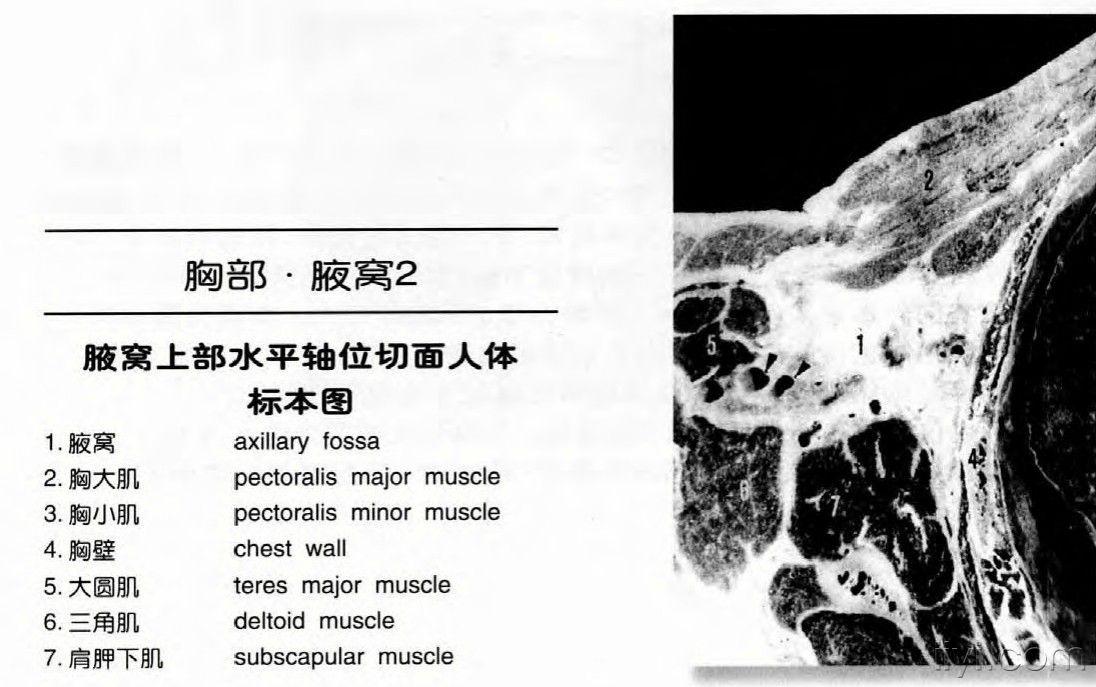 腋窝ct解剖图片