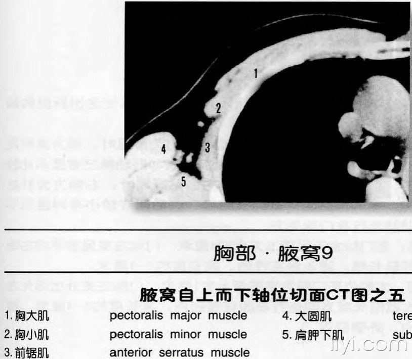 腋窝ct解剖图片