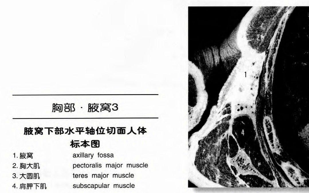 腋窝ct解剖图片