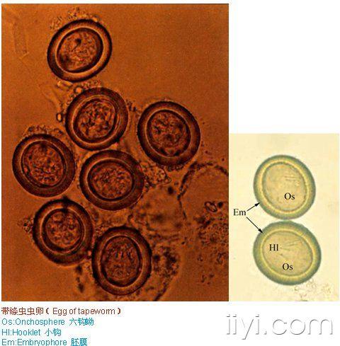 猪带绦虫虫卵呈圆球形或近圆球形,卵壳很薄,自孕节内散出后多已