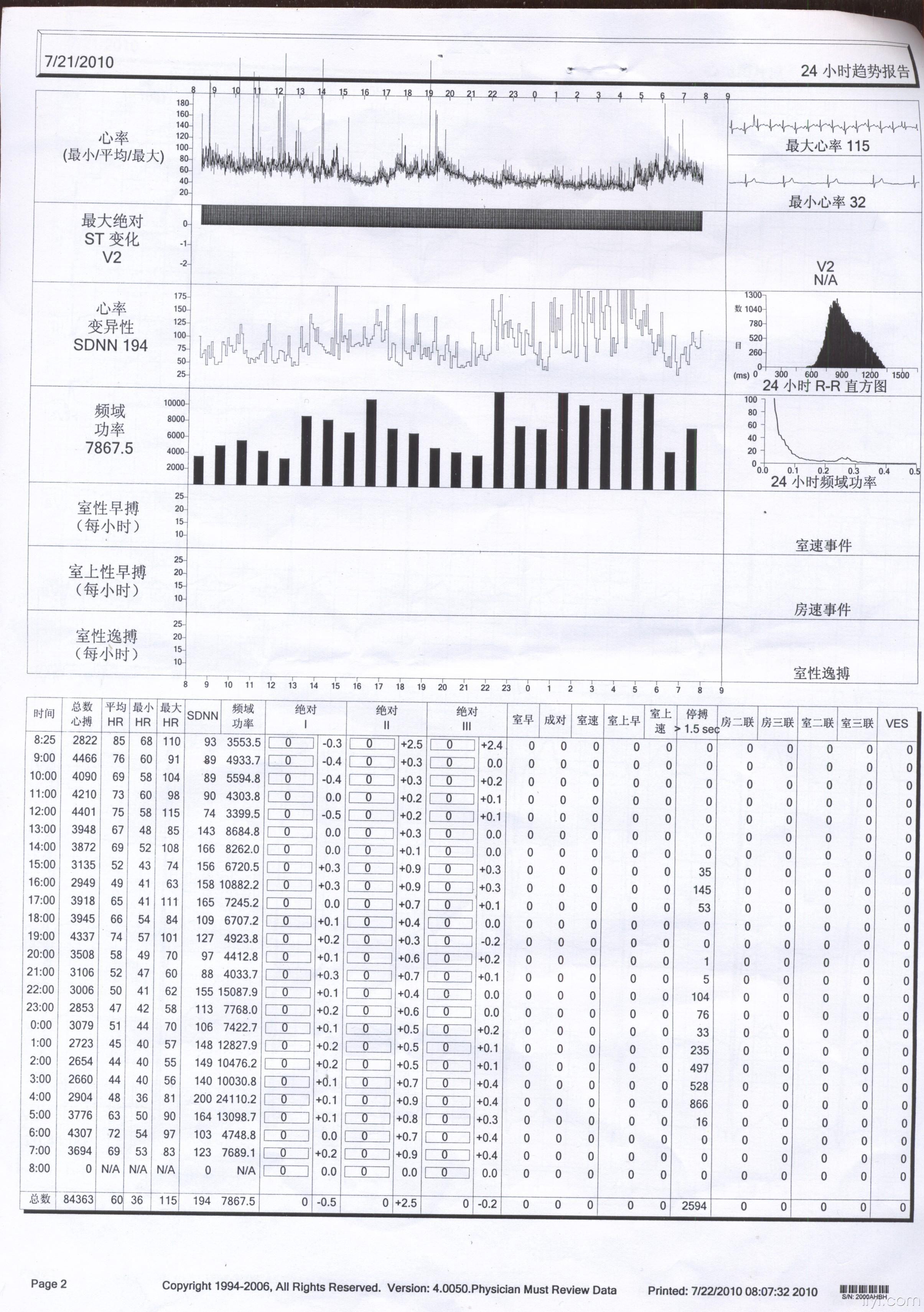 [心电图分析] 心跳慢