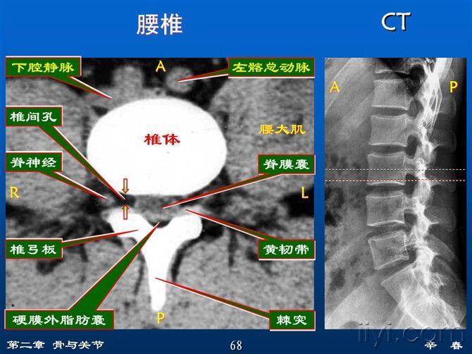 腰椎解剖阅片