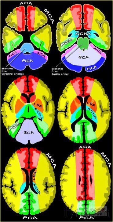 脑动脉的供血区域组图