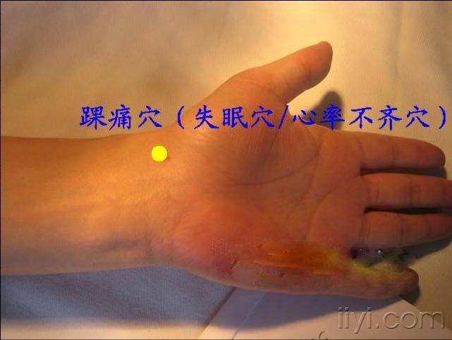 王文远平衡针灸穴位图强帖