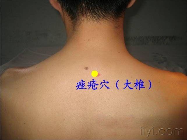 王文远平衡针灸穴位图强帖