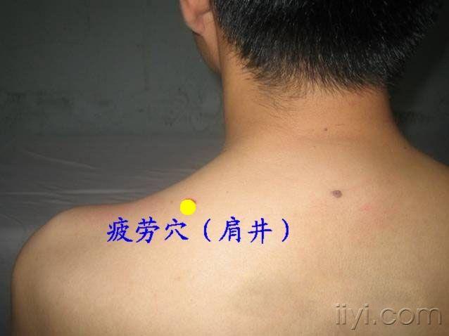 王文远平衡针灸穴位图强帖