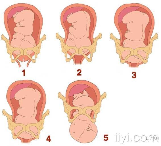 详细图解胎儿分娩过程
