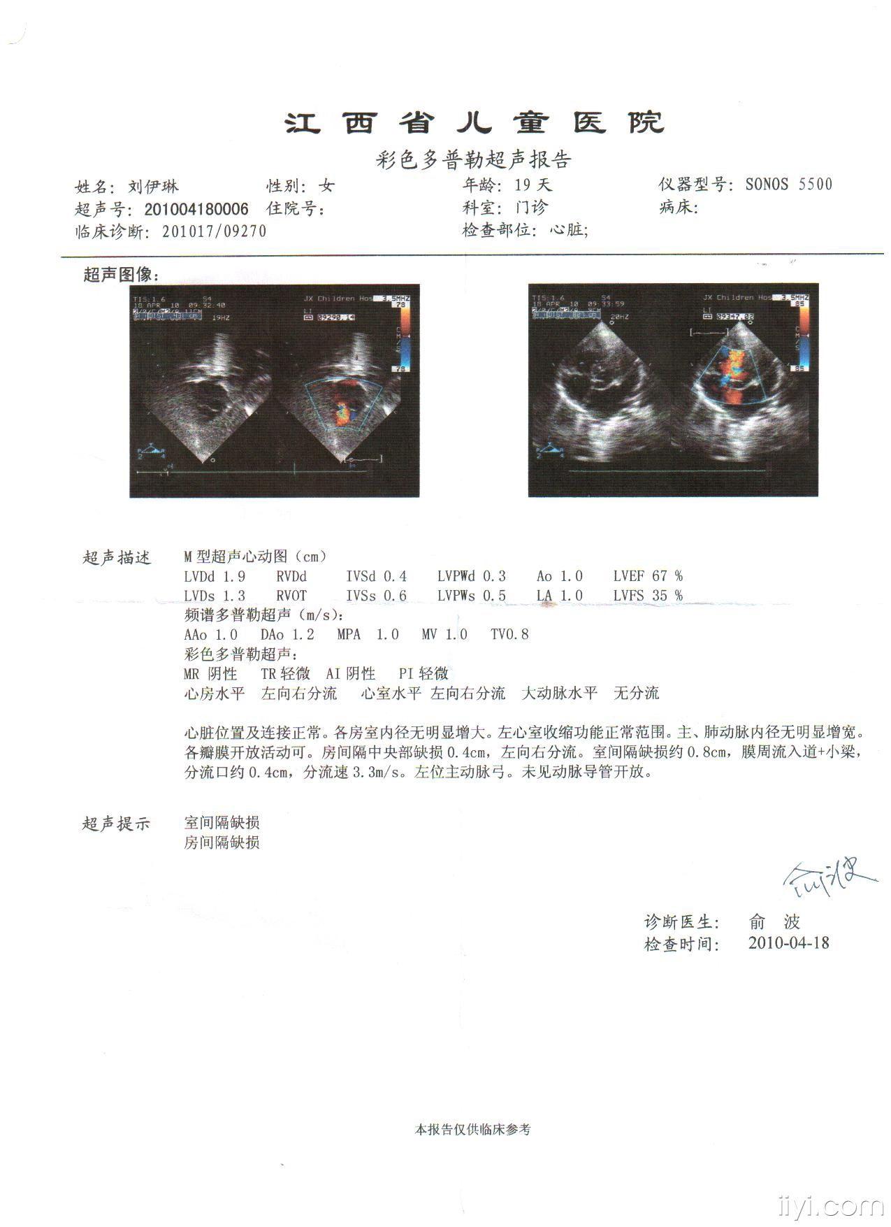 病例讨论室间隔缺损采用何种手术方式比较好