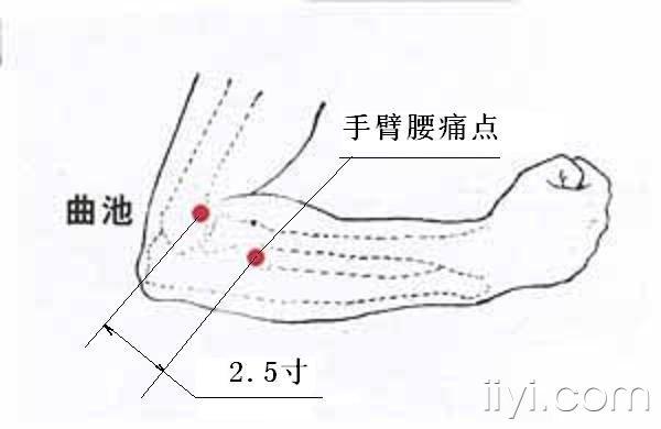 手臂腰痛点一针治愈腰痛