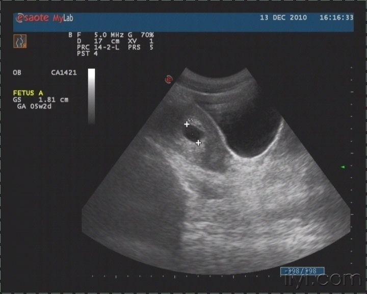 超声医学讨论版 - 爱爱医医学论坛