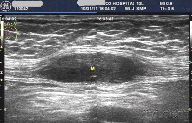 超声医学讨论版 - 爱爱医医学论坛