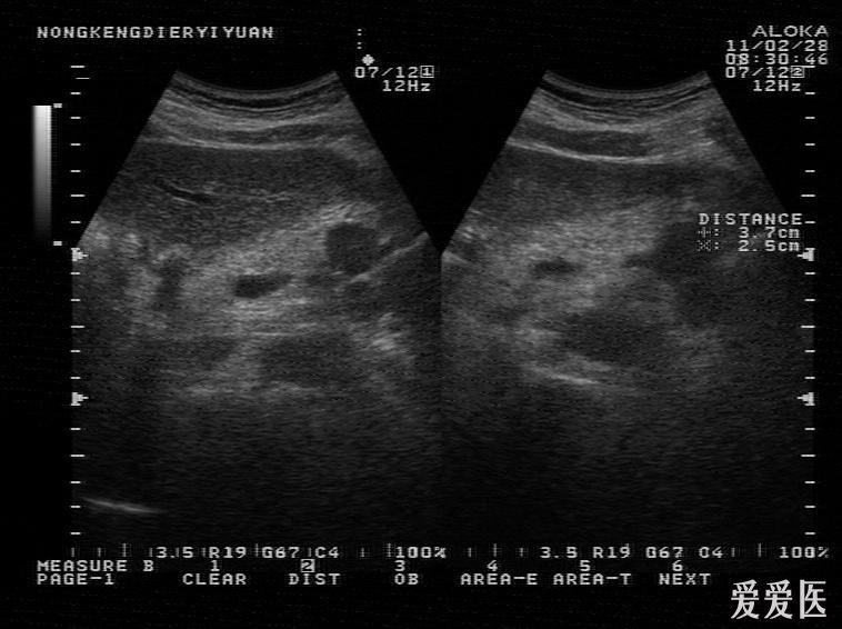 超声医学讨论版 爱爱医医学论坛