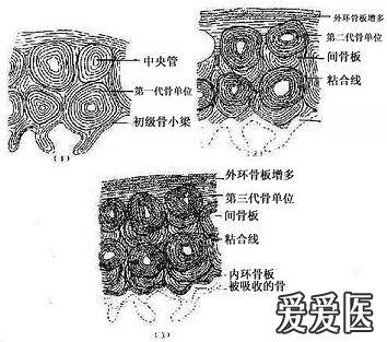 骨密质改建示意图.jpg