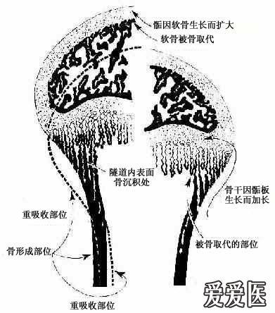 骨干骨密质形成和外形变化及骨骺发育示意图.jpg