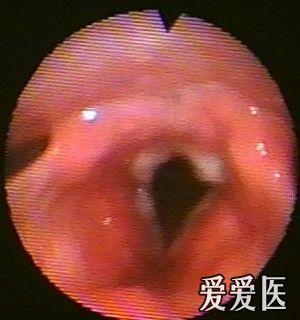 耳鼻咽喉-头颈外科专业版 - 医