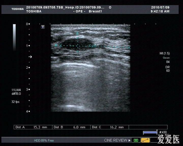 超声医学讨论版 - 爱爱医医学论坛