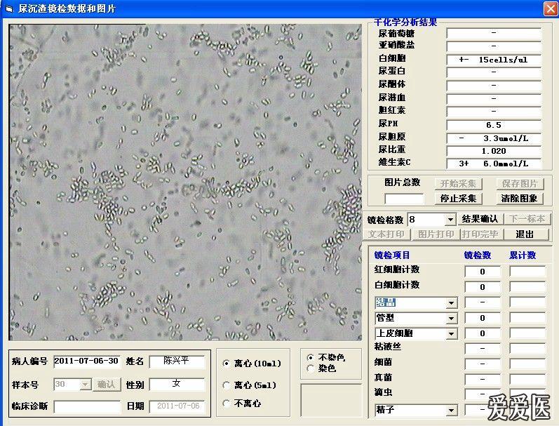 尿沉渣镜下图