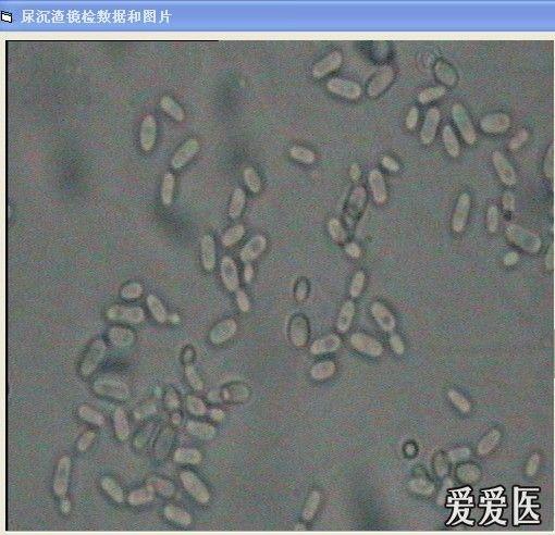 尿沉渣镜下图 - 检验医学讨论版 - 爱爱医医学论坛