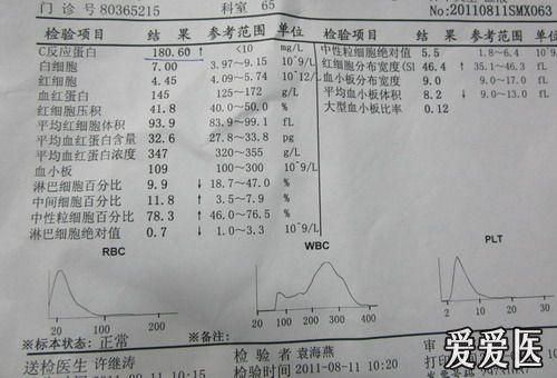 急诊发热待查结果见29楼