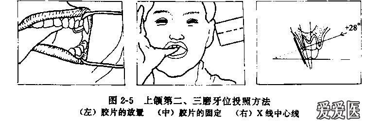 颌面部x线投照技术