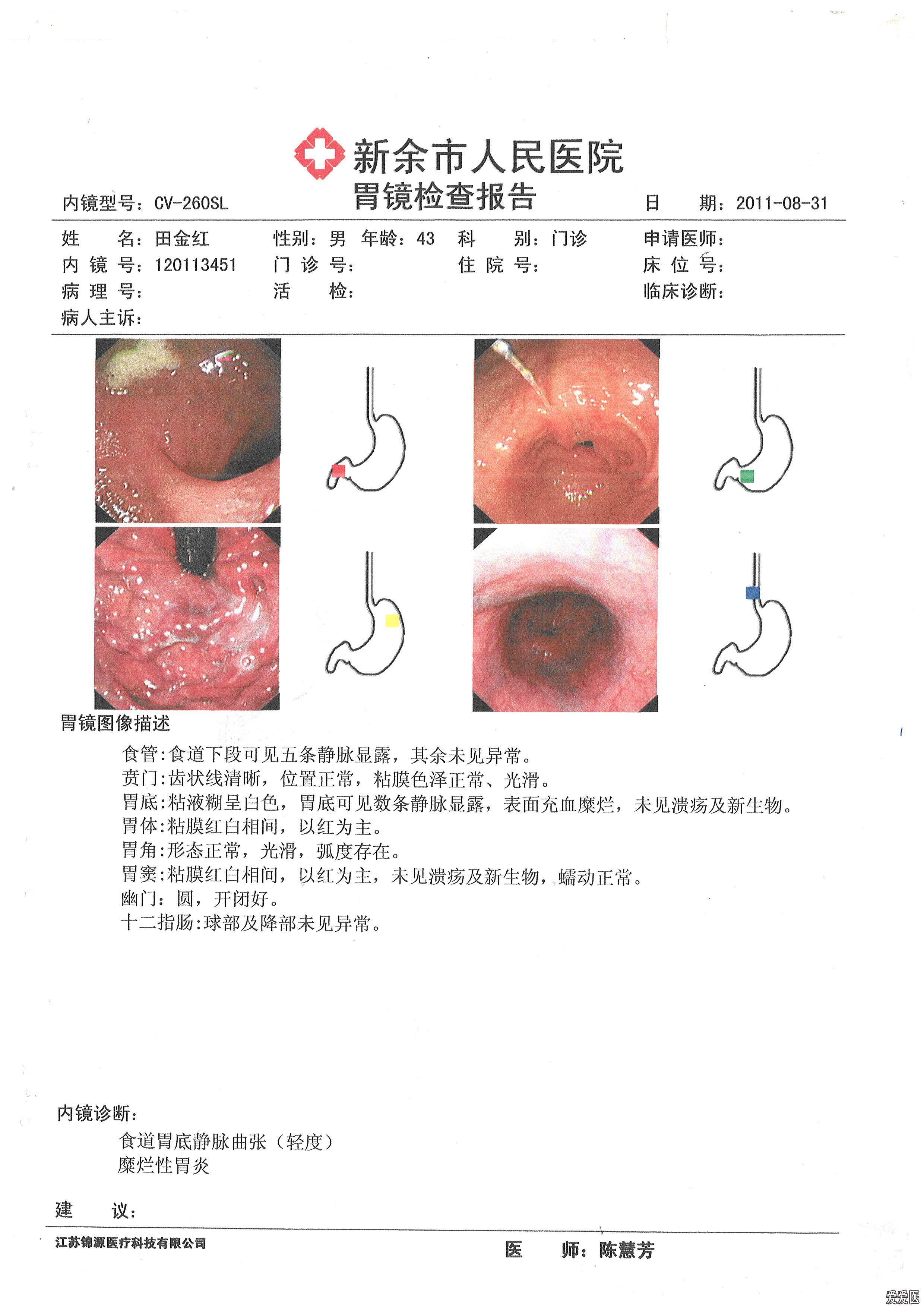 8.31胃镜.jpg