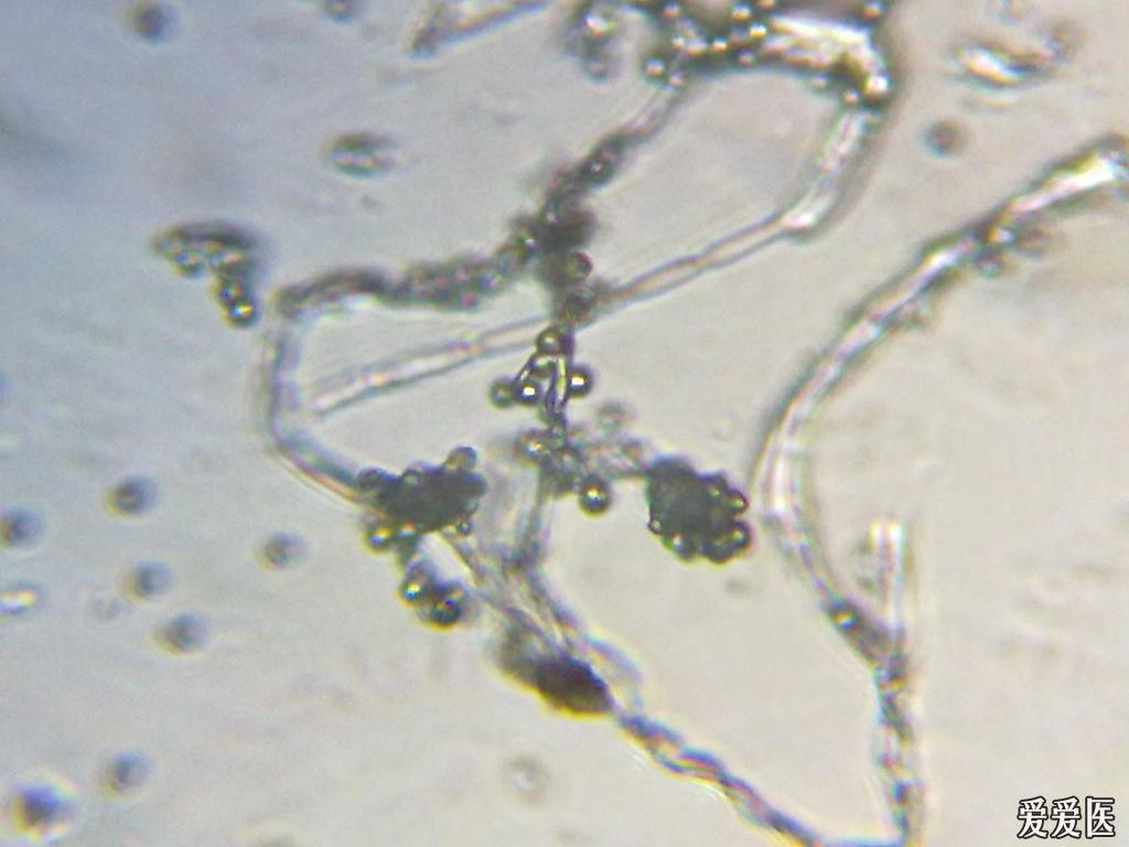 病原体  念珠菌  显微镜  照片