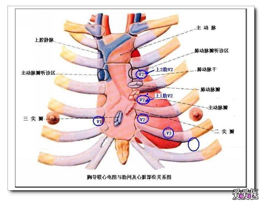 胸导联心电图与肋间及心脏部位关系图
