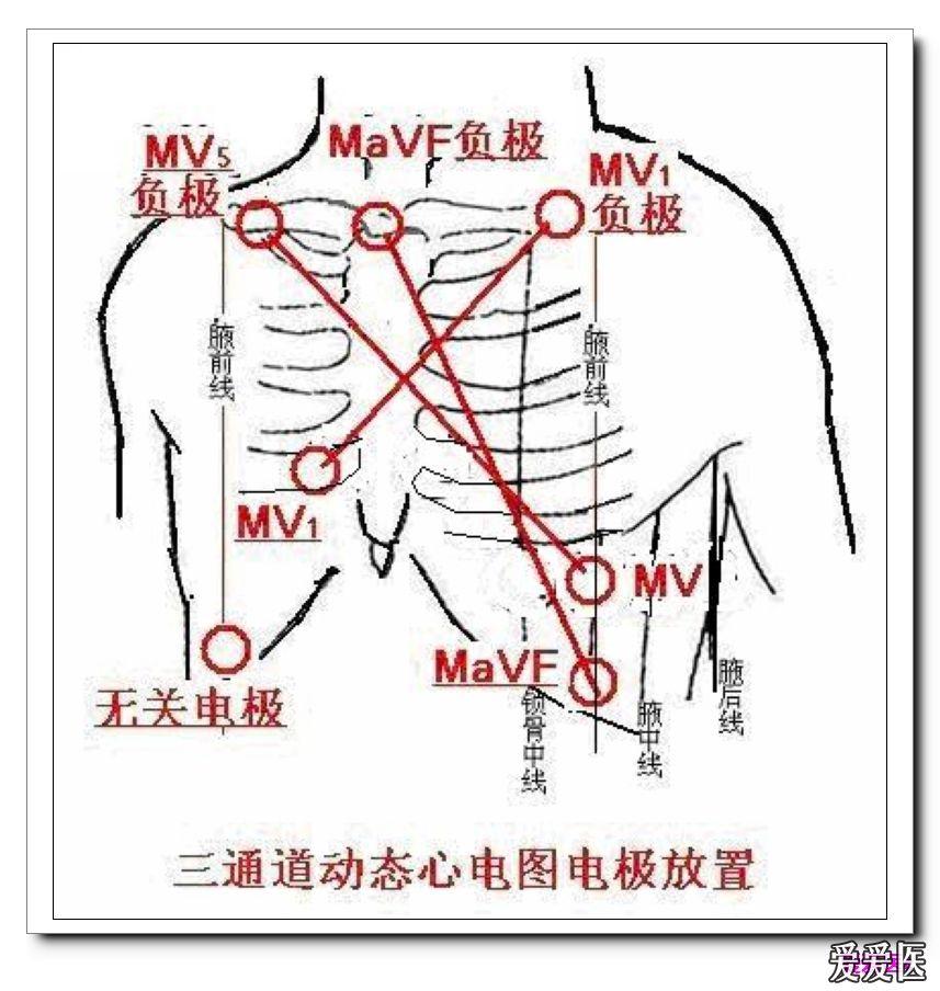 七个电极是红色园圈位置,除标志负极与无关电极处外,为其他是正极!