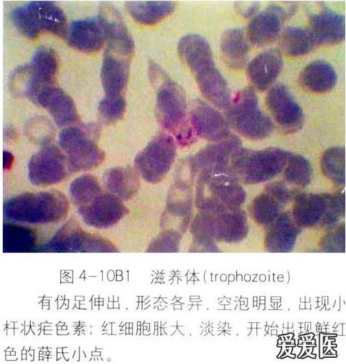 求疟原虫图片