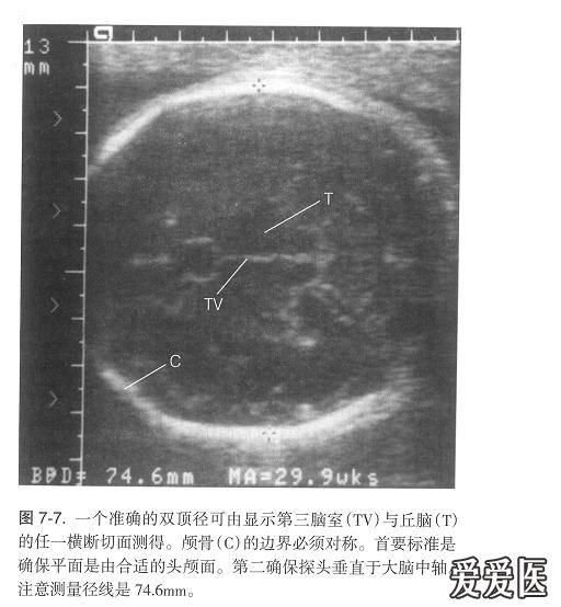 看看我测量的胎儿腹围的切面是否标准?