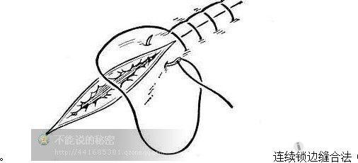外科缝合的基本方法
