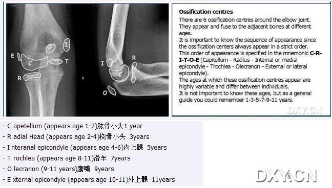 儿童肘关节骨骺.jpg