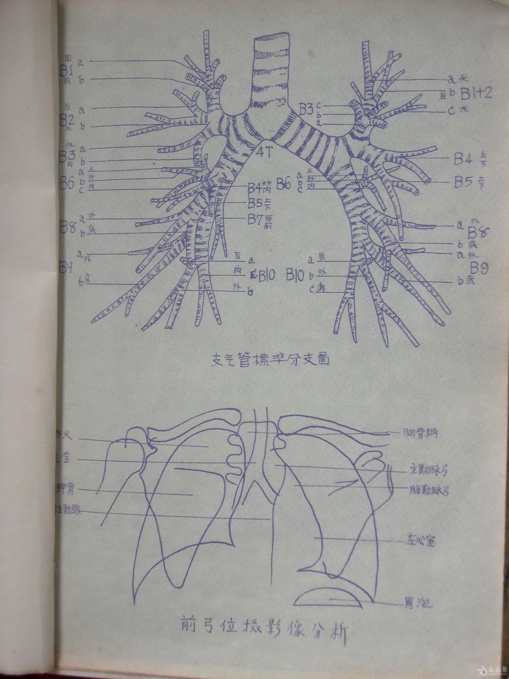 手绘胸部x线解剖