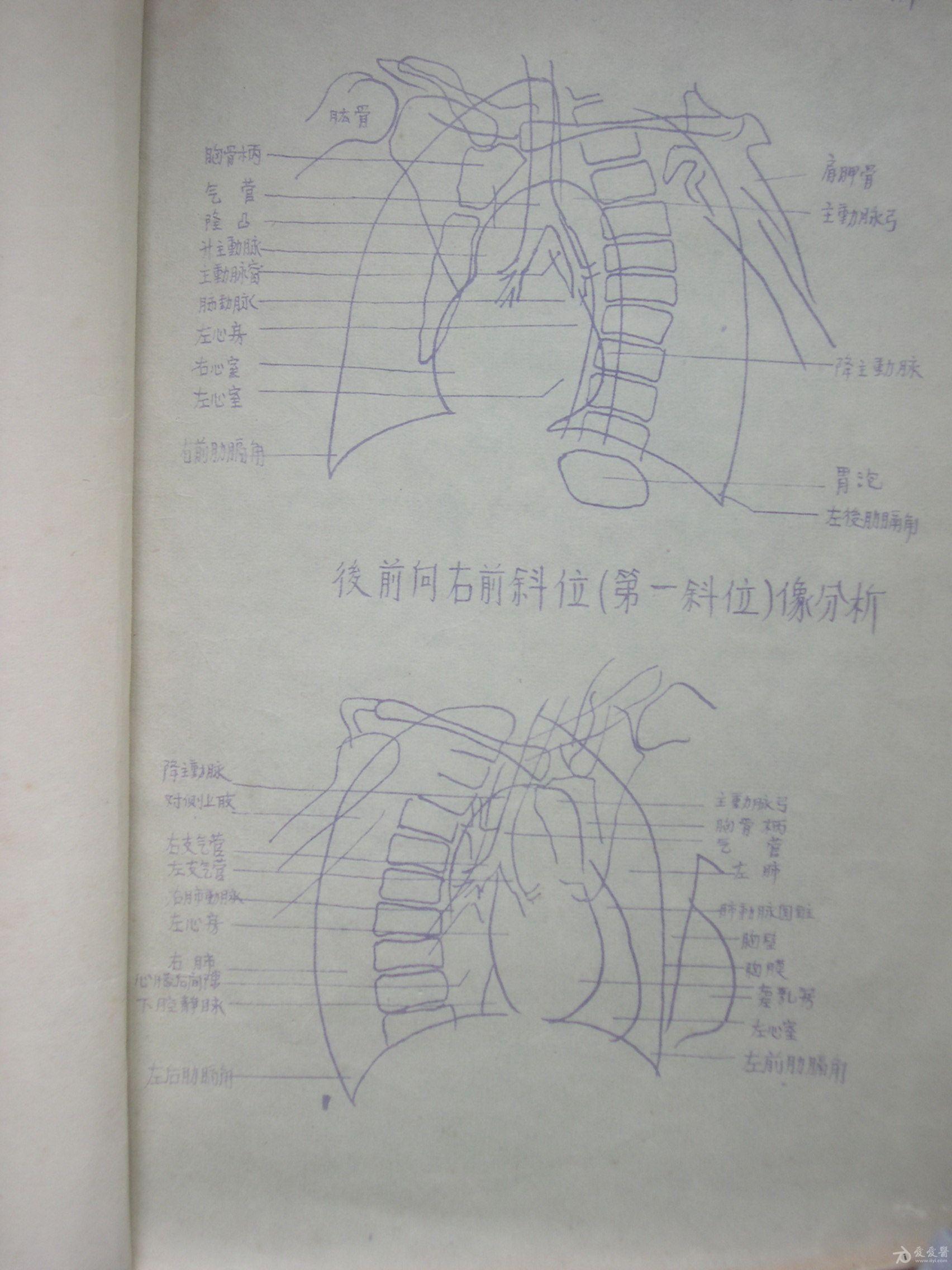 手绘胸部x线解剖