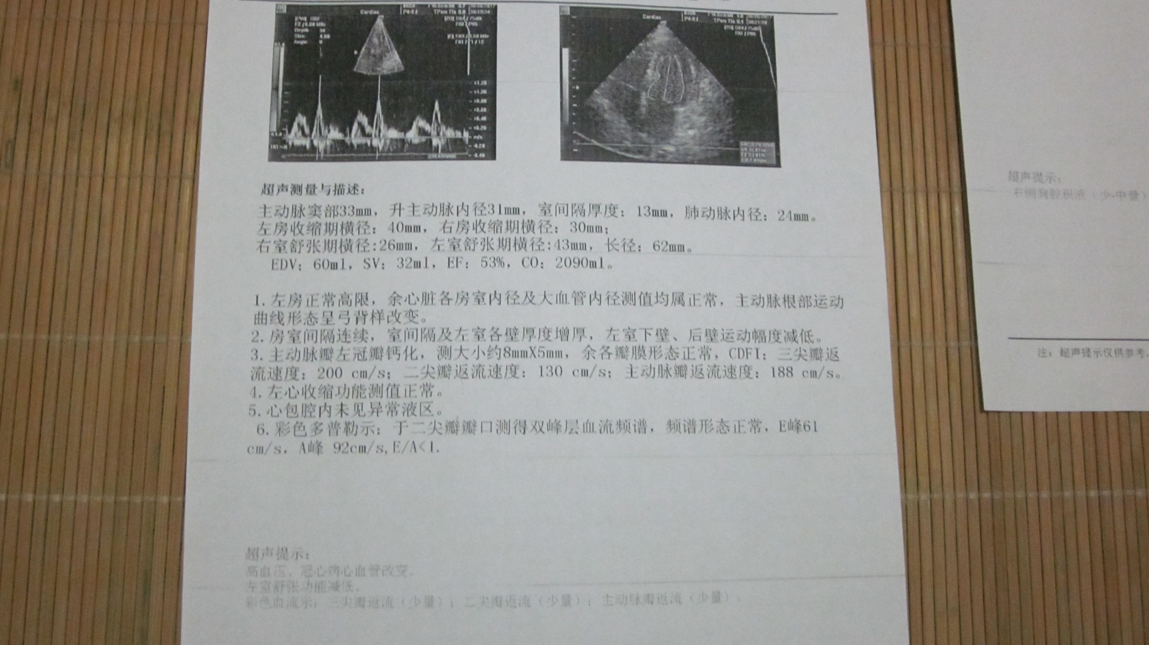 肺部积水好治疗吗