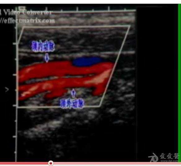 颈部血管课件图 - 超声医学讨论版 - 爱爱医医学论坛