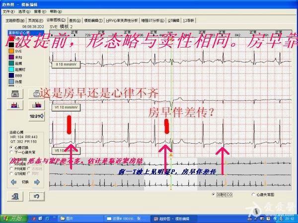 房早伴差传