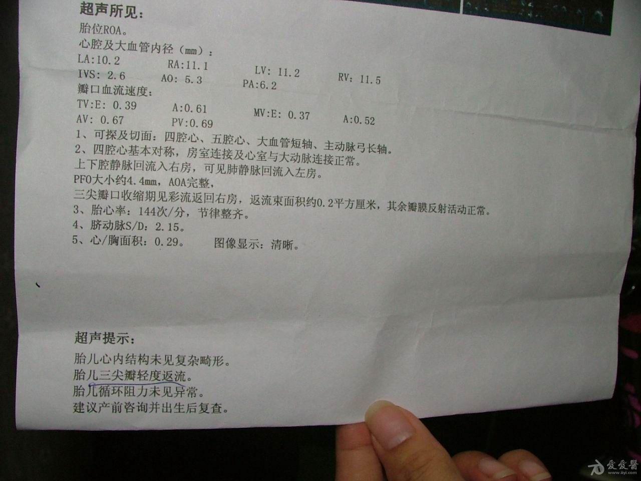 这个彩超结果正常么胎儿超声心动图