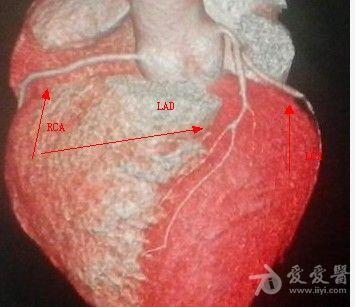cta新手望老师们指教请问哪支是lad