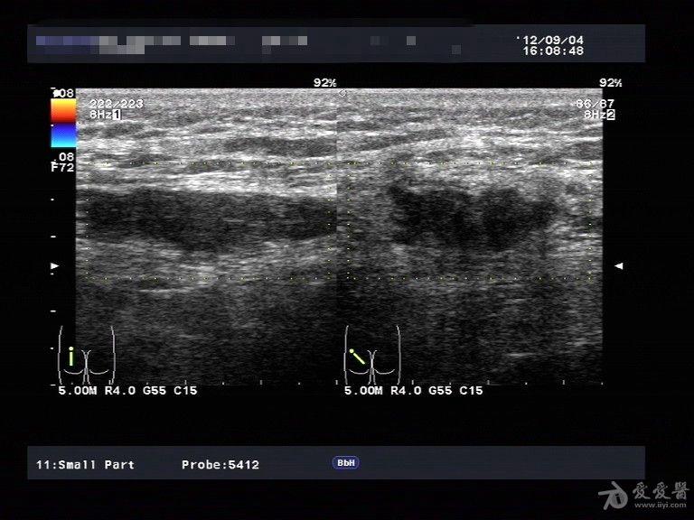 超声医学讨论版 - 爱爱医医学论坛