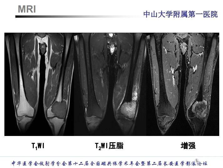 mri全国年会疑难病例讨论-五官骨肌