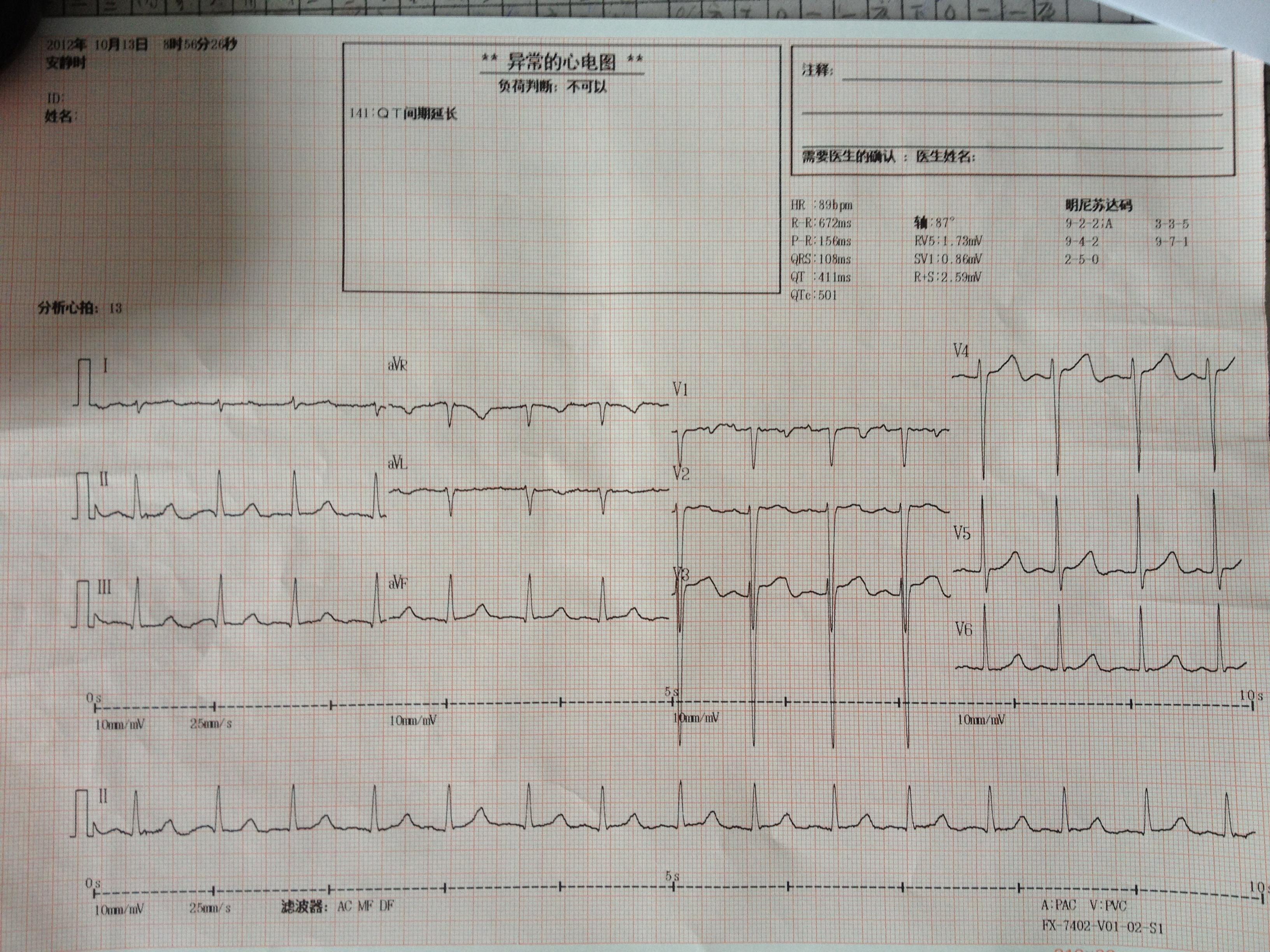 帮我看看这份心电图