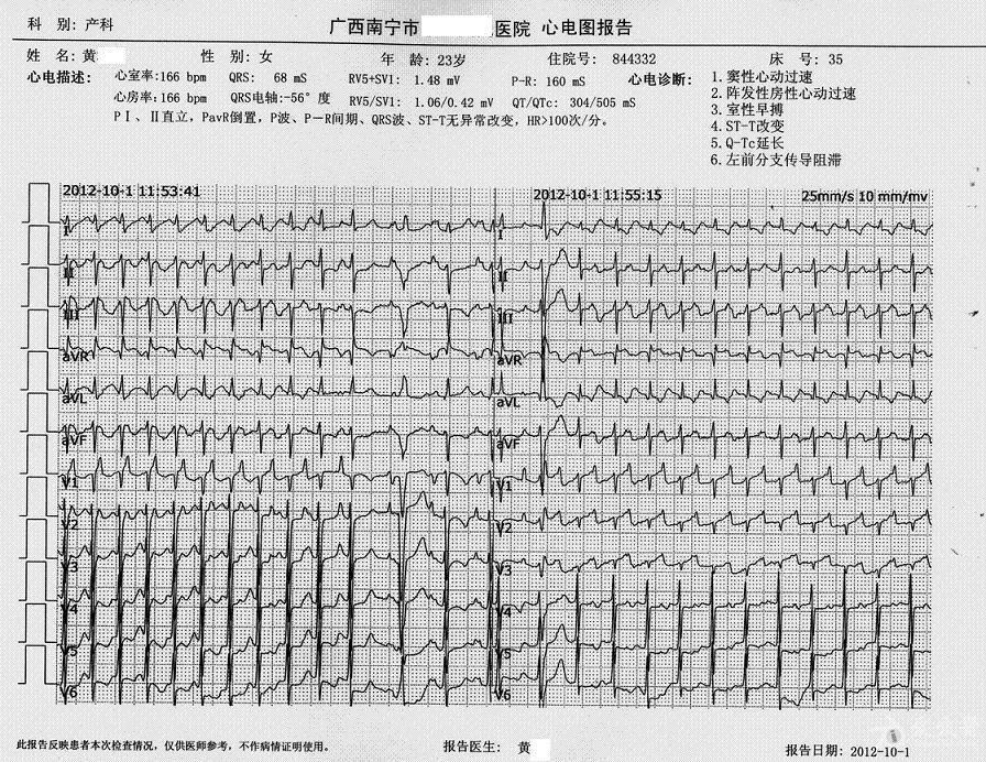 产后患者心电图