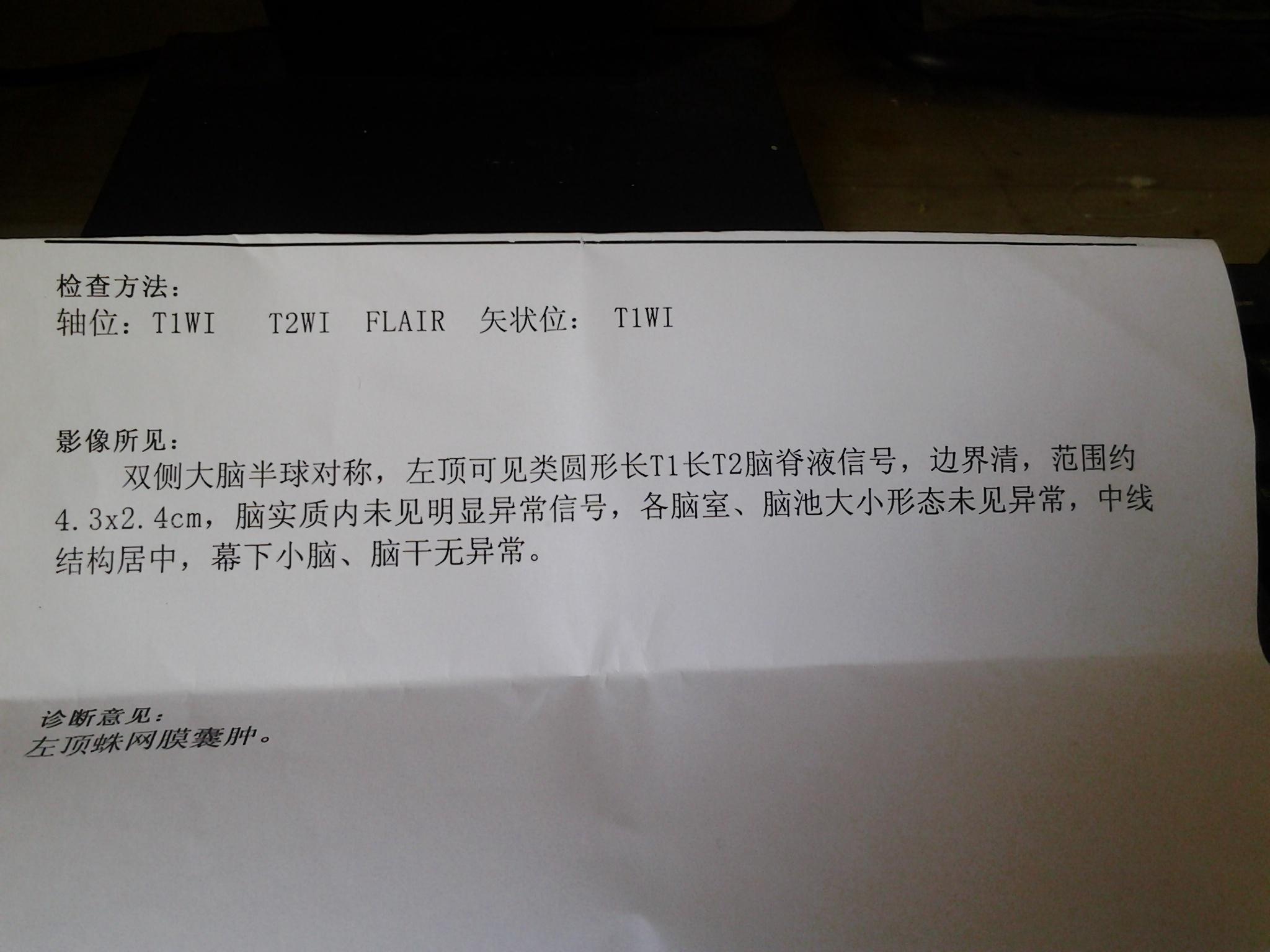 ct:左顶部蛛网膜囊肿!