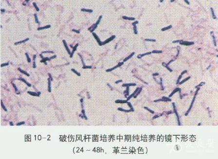 微生物图谱之厌氧菌
